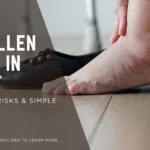 swollen feet in summer heat remedies